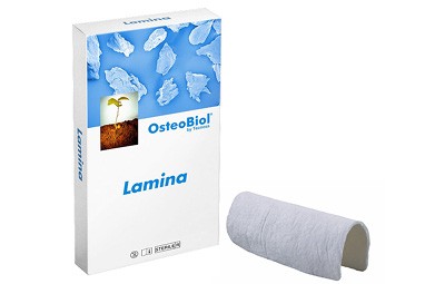 Lamina-382x255